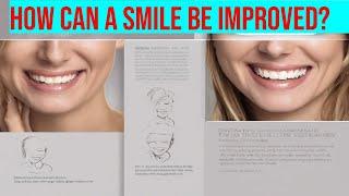 Unlock the Secrets of Smile Design - How Can You Achieve Your Dream Smile?