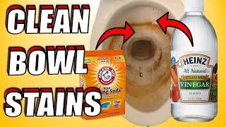 How to Clean Toilet Bowl Stains With Baking Soda & Vinegar