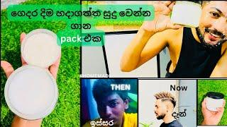 අම්මෝ මෙච්චර සුදු වුනේ කොහොමද?|my skin care routine|natural bleaching එකක්|බෙරි බත් pack|#beauty