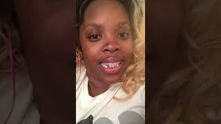 ADULT BRACES  TRANSFORMATION | BIG STEPPER  #braces #transformation #shorts #fypシ゚viral #trending