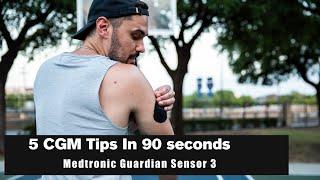 5 CGM Tips from Medtronic Diabetes in 90 Seconds - Guardian Sensor 3