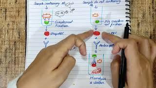 Complement fixation test explained | Principle | Diagram | Flowchart | #medicology