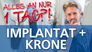 Nur 1 Tag: Implantat setzen und mit Krone versorgen - Ist das machbar?