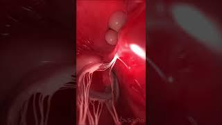  Journey Through the Heart: From Outside to Inside   #anatomy #biology #meded