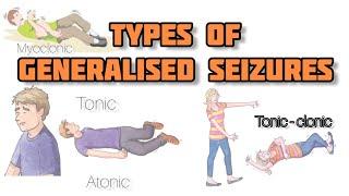 types of Generalised Seizures