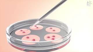 人工受孕（IVF） 簡介 普通話
