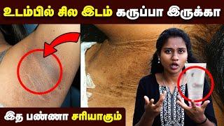 கருமை போக தினமும் இத பண்ணுங்க | Underarm Darkness | Neck Darkness | Skin care