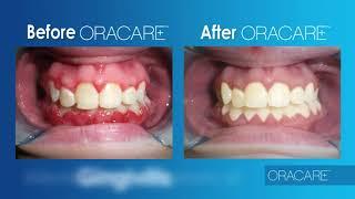 Dr Rashmi Kumra  Dentist Select introduces OraCare ™Dr Rashmi Kumra