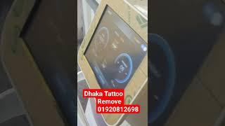 dhaka tattoo remove centre #shorts