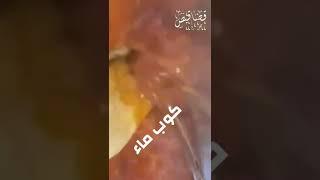 صينية بطاطس بالكفته في الفرن