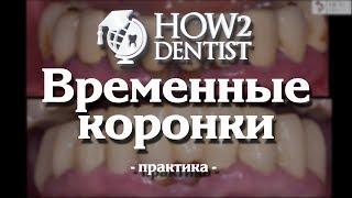 Как изготовить временные коронки. Часть 3 - Практика / How to Dentist