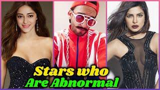 10 Bollywood Stars Who Are Not Normal