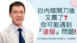 白內障術後又看不清楚兩分鐘了解續發性白內障️｜台中中國醫藥大學附設醫院眼科醫學中心 張硯傑醫師