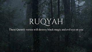 RUQYAH - Spiritual Treatment For Black Magic, Jinn & Evil Eye | Omar Hisham Al Arabi | Qadri Records