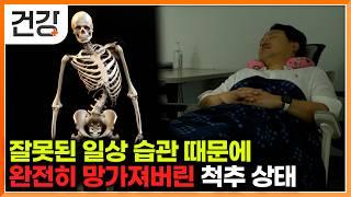 나도 모르게 다리 꼬고, 이상하게 앉았던 행동들이 척추측만증이 되어 돌아왔다｜척추측만증 집에서 수술 없이 고치는 법｜귀하신 몸｜#EBS건강