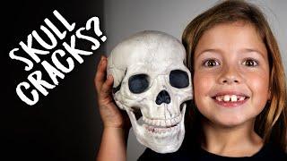 Why Are There Cracks In Our Skull - Sutures Of Skull - Skull Anatomy Bones