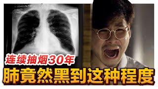 抽烟抽了30年 要怎样戒烟?? 戒烟副作用超严重 导致精神分裂… 你还敢抽烟吗?｜低清 Dissy｜搞笑日常｜