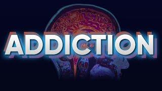 The Science of Addiction and The Brain