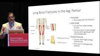 Care Complications: Bone Fractures