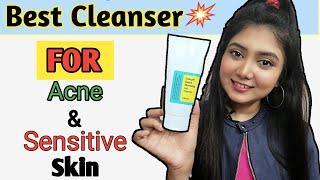 Best Acne Cleanser For Sensitive Skin || COSRX Low Ph Good Morning Gel Cleanser Review - 2020