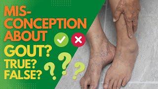 Misconceptions About Gout! TRUE? FALSE?