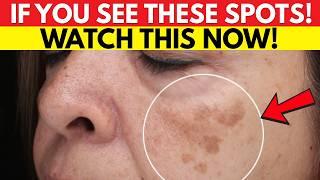 The #1 Mineral You Need to Prevent Age Spots According to Experts