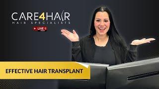 How to get an effective hair transplant at Care4Hair