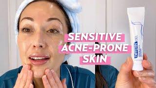 A Nighttime Skincare Routine for Sensitive, Acne-Prone Skin | Skincare with @SusanYara