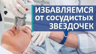 Удаление сосудов лазером.  Как удалить сосуды с помощью лазера. Скандинавский центр здоровья