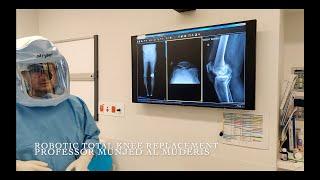 Robotic Total Knee Replacement - Professor Munjed Al Muderis