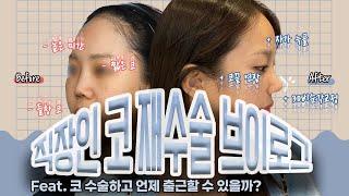 [직장인의 현실 코재수술 브이로그] 예쁜데 더 예뻐진 그녀의 붓기 관리 등 꿀팁까지 모두 알려드림 ~수술 당일부터 1주차~