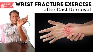 Broken Wrist Exercises After Taking Off Cast| Wrist Fracture Exercise