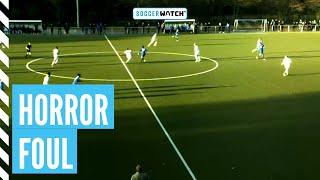 Blutgrätsche von hinten in die Beine! | Amateurfußball pur bei soccerwatch.tv