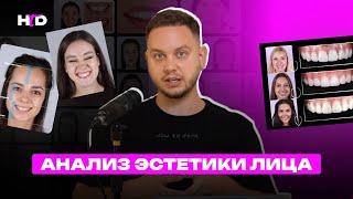 Анализ эстетики лица | PROвиниры Прокопович Виктор