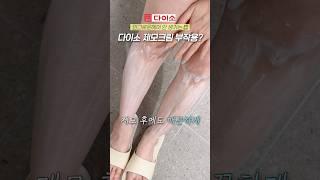 다이소 화장품 사기 전 필수시청 제모 인그로운헤어 제발 이렇게 해보세요!! #다이소추천템 #제모 #뷰티꿀팁