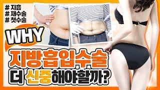 지방흡입 첫수술&재수술 (SUB)지방흡입수술 왜 신중히 결정해야할까??  (liposuction)