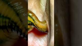 Leech bite under the microscope!