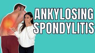 What you can do for Ankylosing Spondylitis