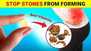 5 Best Vitamins to Prevent Stones and Heal Your Kidneys