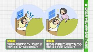 【睡眠時無呼吸症候群】①原因と起こり得る合併症について考える