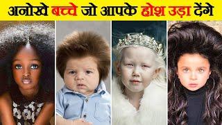 लाखो में एक है ये अनोखे बच्चे | 10 Most UNUSUAL Kids In The World | Kids You Won't Believe Exist