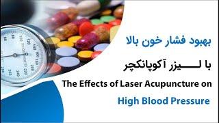 بهبود فشار خون با طب سوزنی و لیزر آکوپانکچر --- The Effects of Laser Acupuncture on Hypertension