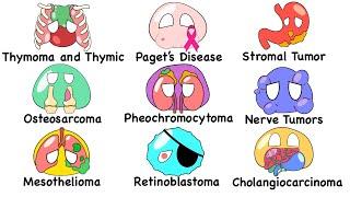 Every RARE Cancer Explained in 12 Minutes