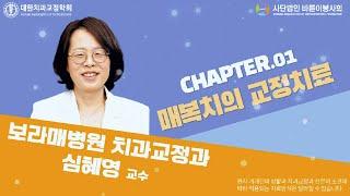 [EP.36] 선생님!! 저 궁금한 게 있는데요? : 매복치의 교정치료Ⅰ