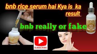 bnb rice whitening serum review.............,..........bnb products rice serum honestly review