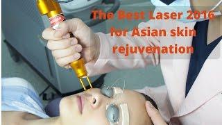 Best Laser for Asian Skin Rejuvenation