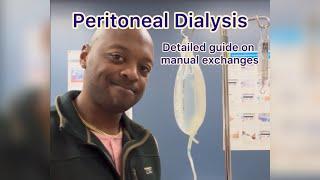 Peritoneal Dialysis (PD) a detailed guide on how to do manual exchanges #dialysis #pd #homedialysis