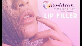 Juvederm Volbella Lip Line and Lip Filler l Total Dermatology