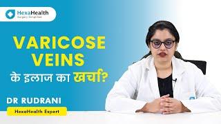 How much does Varicose Veins Surgery Cost in India? || HexaHealth expert Dr. Rudrani Dhole