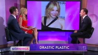 Dr William Mooney Plastic Surgery and Celebrities "Drastic Plastic"